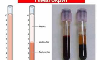 Если гематокрит понижен у ребенка в крови,что это значит?