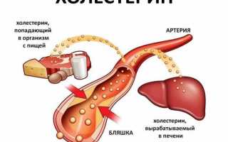 Холестерин в крови у женщин — норма по возрасту в таблице, причины низких и повышенных значений