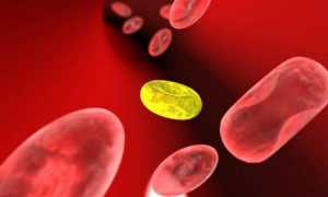 Как быстро и эффективно понизить билирубин в крови в домашних условиях