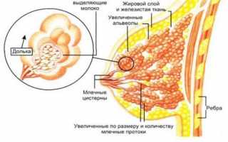 Что такое железистая гиперплазия молочной железы?