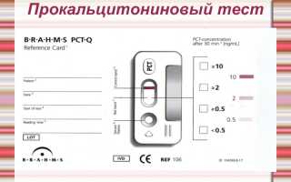 Что такое прокальцитониновый тест,интерпретация результатов, нормы