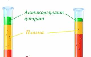 Что такое гематокрит в анализе крови,его норма у женщин по возрасту в таблице