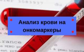 Онкомаркер щитовидной железы – названия, нормы, об анализе и раке щитовидки