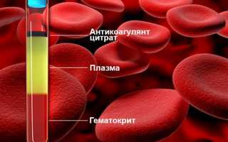 Гематокрит повышен у ребенка-что это значит и что делать?