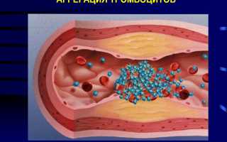 Агрегация тромбоцитов — что это такое,расшифровка анализа и методы исследования