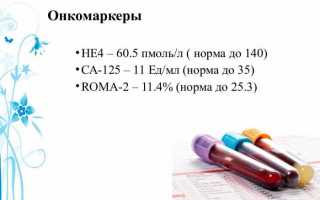 Что такое онкомаркер не4,  что означает анализ крови на he4 с расшифровкой