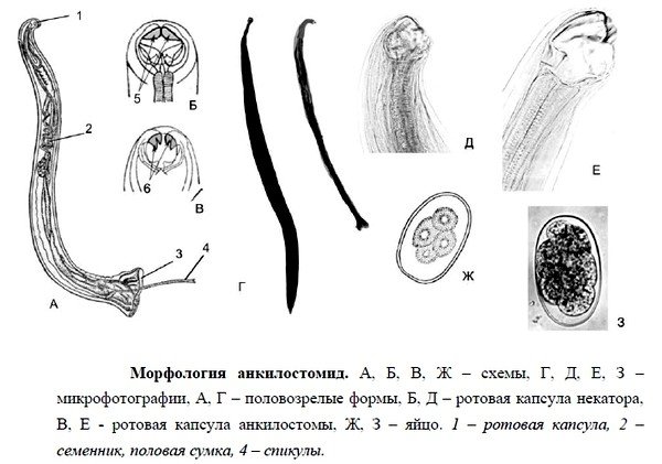 Симптомы анкилостомоза